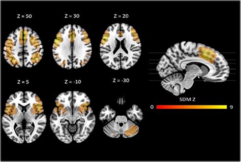 Frontiers Neural Correlates Of Verbal Working Memory An Fmri Meta