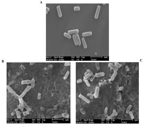 Morphological Characteristics Of Lactobacillus Acetotolerans 2011 8