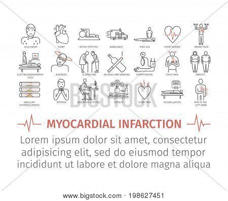 Myocardial Infarction Vector Photo Free Trial Bigstock