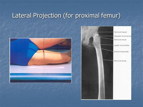 Radiographic Positioning Of The Femur And Tib Fib Ce4rt 40 Off