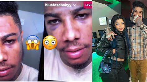 Chrisean Rock Showoff Photo Of Blueface Black Eyes She Gave Him On Ig