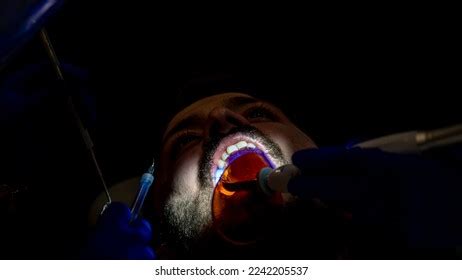 Laser Endodontics Images Stock Photos Vectors Shutterstock