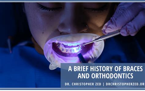 A Brief History Of Braces And Orthodontics Dr Christopher Zed