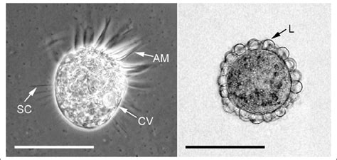 Live Specimens Of Meseres Corlissi CCAP 1647 1 Active Left And