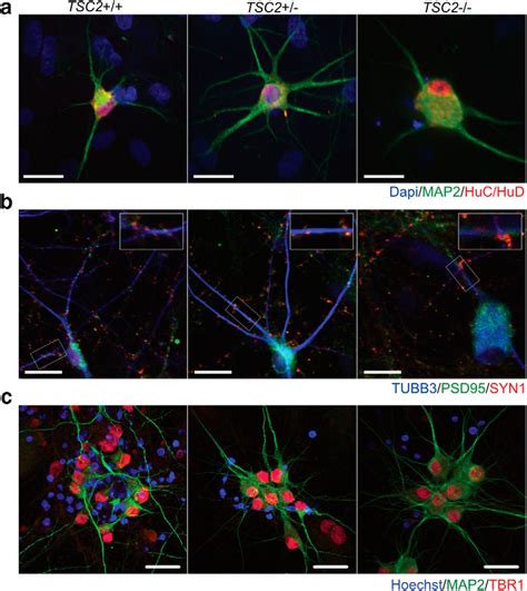 Biallelic Mutations In Tsc2 Lead To Abnormalities Associated With