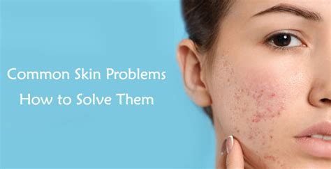 common skin problems    solve