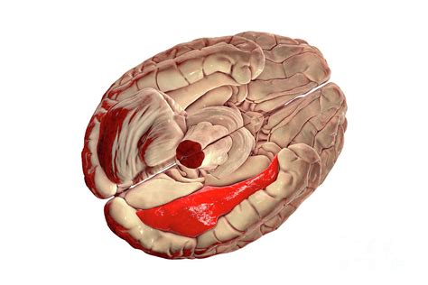 Human Brain With Highlighted Fusiform Gyrus Photograph By Kateryna Kon