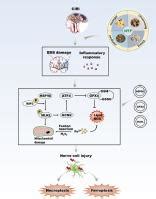 Crosstalk Between Ferroptosis And Necroptosis In Cerebral Ischemia