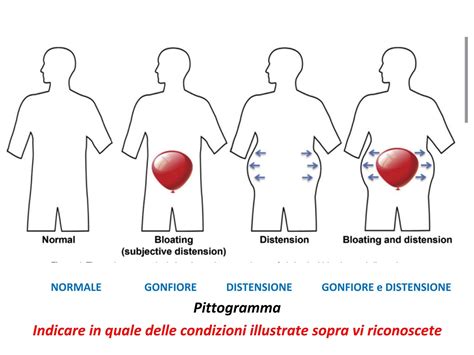 Cura Della Pancia Gonfia Milano Frosi Dr Alberto