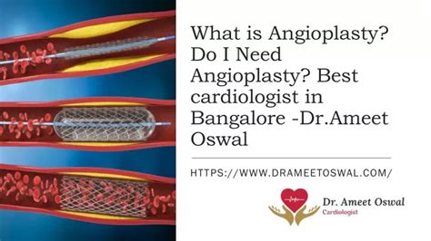 Ppt What Is Angioplasty Do I Need Angioplasty Best Cardiologist In