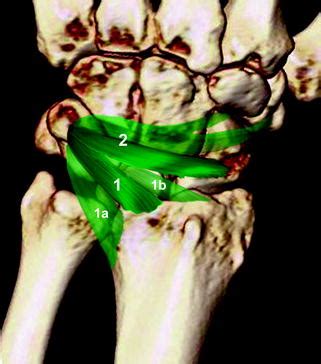 14 The dorsal carpal ligaments: Dorsal radiocarpal ligament (1). The ...