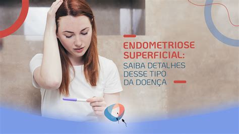 Endometriose superficial saiba detalhes desse tipo da doença Dr