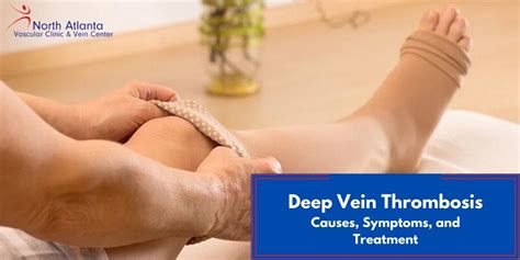 Deep Vein Thrombosis Definition Symptoms And Treatment 40 OFF