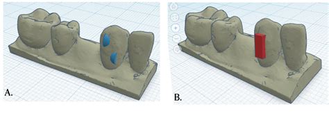 Figure 1 from Effects of different aligner materials and attachments on orthodontic behavior ...