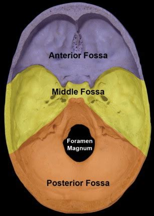 Base Of Skull Fracture Signs