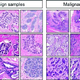 Benign And Malignant Samples With Different Pixels Resolutions