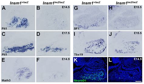 Transcription Factors That Regulate Differentiation Of Endocrine Cells