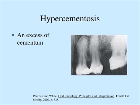 Ppt Dental Anomalies Powerpoint Presentation Id3700780