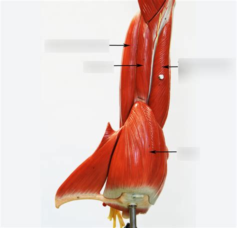 Arm Lateral Diagram Quizlet