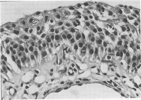 Stratified Cuboidal Epithelium - Biology Notes Online