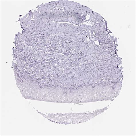 Tissue Expression Of Lrp2 Staining In Vagina The Human Protein Atlas