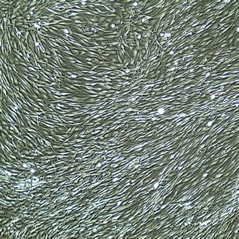 Human Dermal Fibroblasts Adult Primary Cells