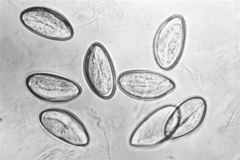 pinworm-eggs-microscope | ReptiFiles