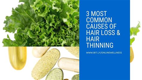 3 Most Common Causes Of Hair Loss And Hair Thinning Youtube