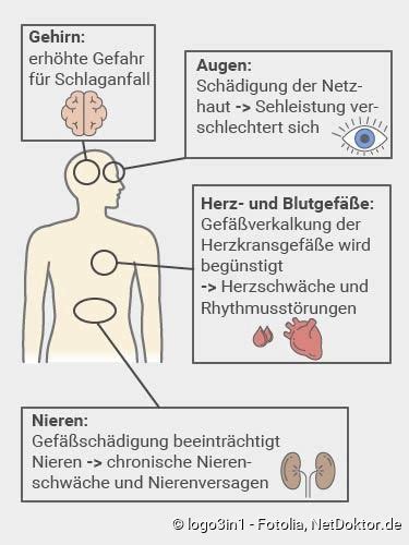 Bluthochdruck Warnsignale Ursachen Therapie NetDoktor