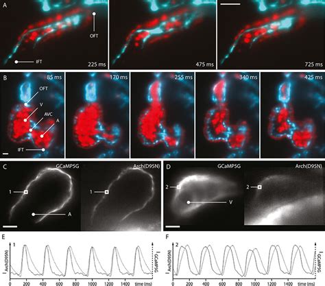 Optical Sections Of Embryonic Zebrafish Hearts Recorded With Light