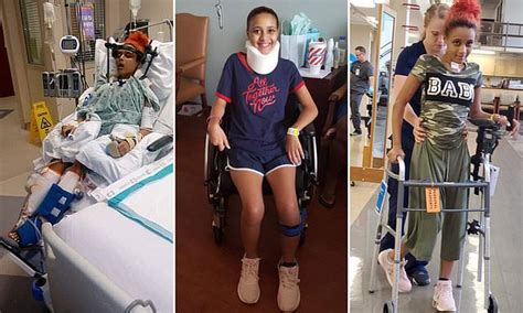 Girl 17 Left Paralyzed In Crash When Her Skull Detached From Her Spine Defies Odds To Walk