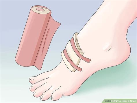 14 Ways To Heal A Scab Wikihow