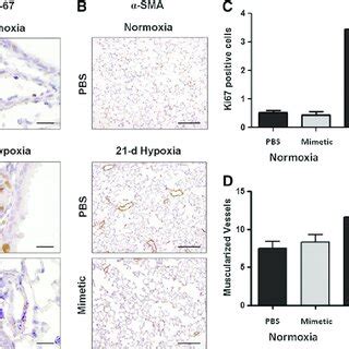 SOD Mimetic Attenuates Chronic Hypoxia Induced Pulmonary Hypertension