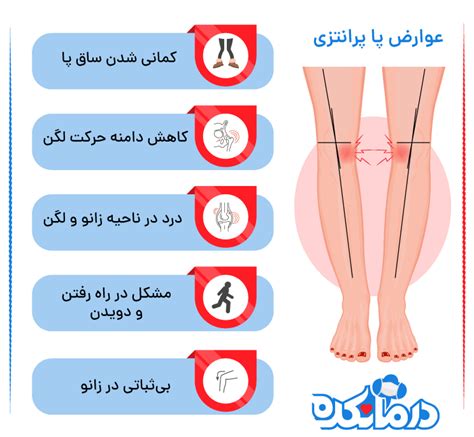 زانوی پرانتزی علت، راه‌‌های تشخیص و درمان پای پرانتزی