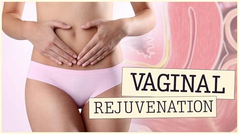 Vaginal Laser Rejuvenation ⚕️ All You Need To Know 👩⚕️ Youtube