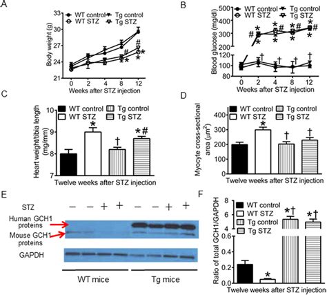 Human Gtp Cyclohydrolase Gch Transgene Drives Gch Protein