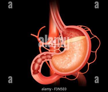 Stomach Acidity Illustration Stock Photo Alamy