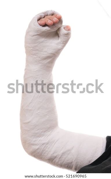 9759 White Arm Cast Images Stock Photos 3d Objects And Vectors