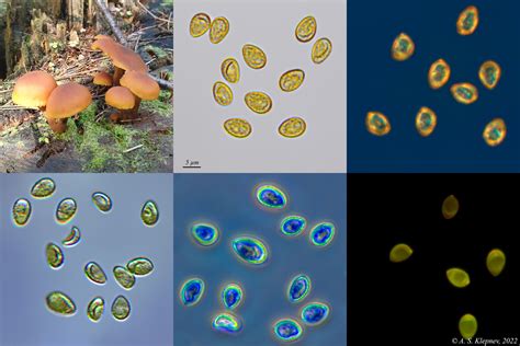 Brightfield Microscopy Fungal Spores