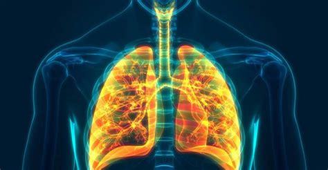 Cells Damaged By Chronic Lung Disease Can Result In Severe Covid