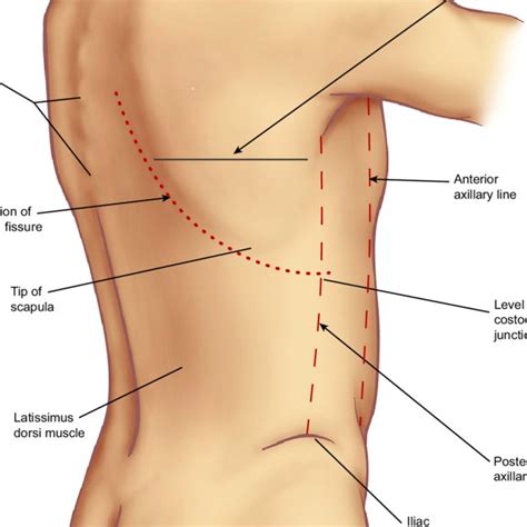 PDF Surface Anatomy And Surface Landmarks For Thoracic Surgery