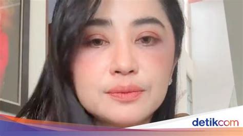 Dewi Perssik Pamer Wajah Tanpa Makeup Bekas Operasi Bawah Matanya Terlihat