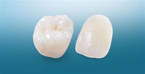 All Ceramics New West Dental Ceramic Ips E Max Crowns And Veneers