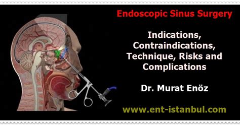 Endoscopic Sinus Surgery