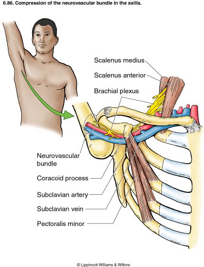 Can Osteopathy Help Thoracic Outlet Syndrome Laurie Melrose Doering