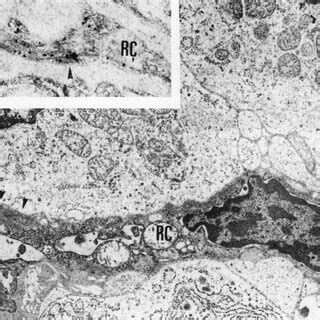 Electron Micrograph Of Splenic Arteriole At The Junction Of Red And