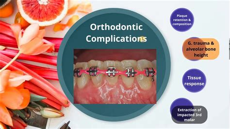 Predisposing Factors To Periodontal Disease 2 Youtube