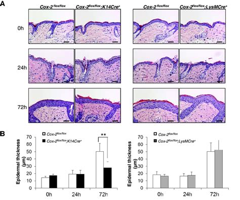 Epidermal Hyperplasia Is Reduced In Response To Uvb Irradiation In Mice