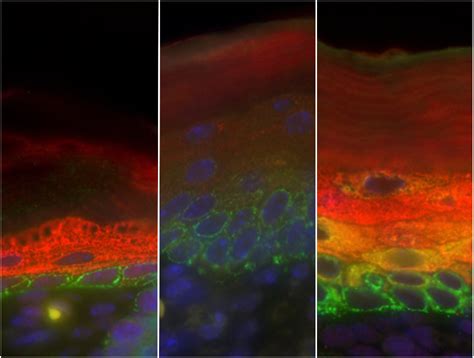 How Stem Cells Make Skin Embl