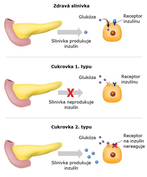 O cukrovce